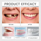 Temporary Silicone Cosmetic Dentures for Missing Teeth