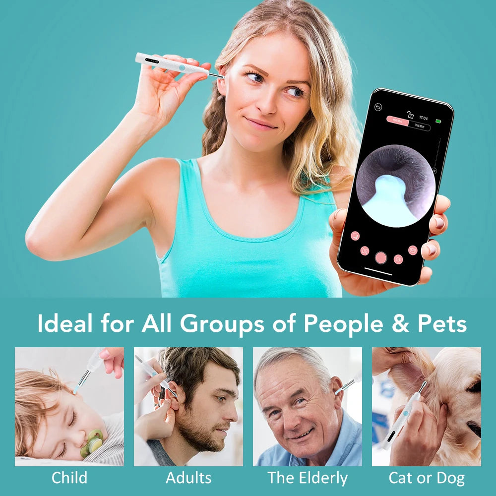 Smart Visual Ear Wax Removal Tool with HD Camera