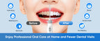 Electric Water Flosser for Teeth with 8 Nozzles and 10 Pressure Settings