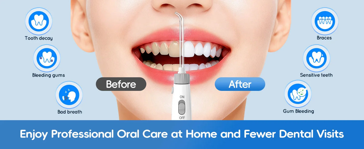Electric Water Flosser for Teeth with 8 Nozzles and 10 Pressure Settings