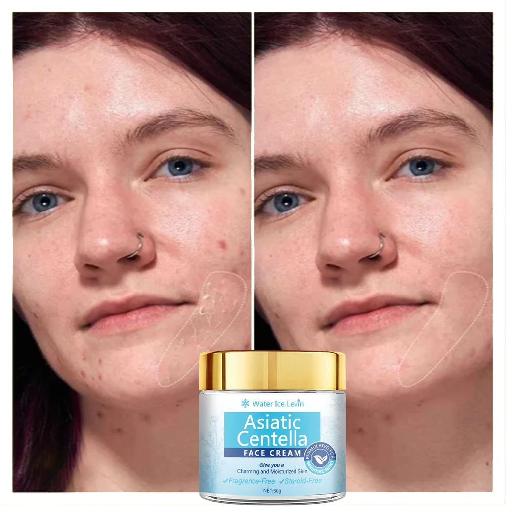 Centella Asiatica Face Cream Moisturizer Skin Barrier Repair 60g