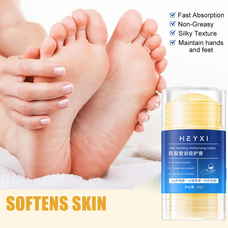 Heyxi Moisturizing Repair Balm Anti Cracking Cream for Hands and Feet