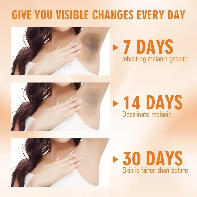 Vitamin C Skin Brightening Cream for Dark Spots and Underarms