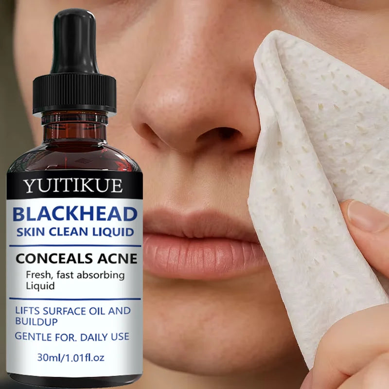 YUITIKUE Blackhead Remover Serum Pore Refining Face Treatment 30ml