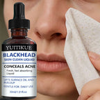 YUITIKUE Blackhead Remover Serum Pore Refining Face Treatment 30ml