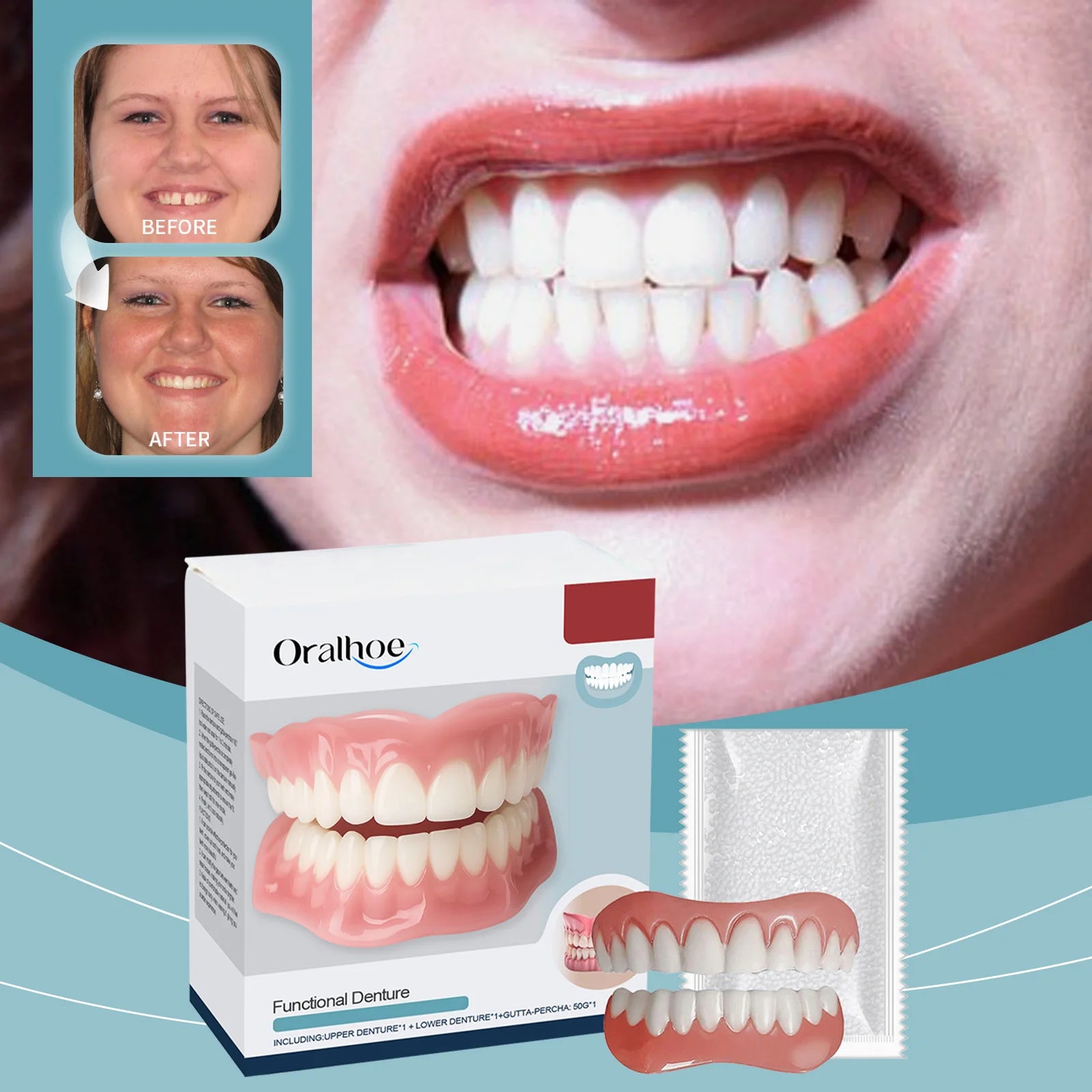 Temporary Silicone Denture Kit for Smile Restoration - 3