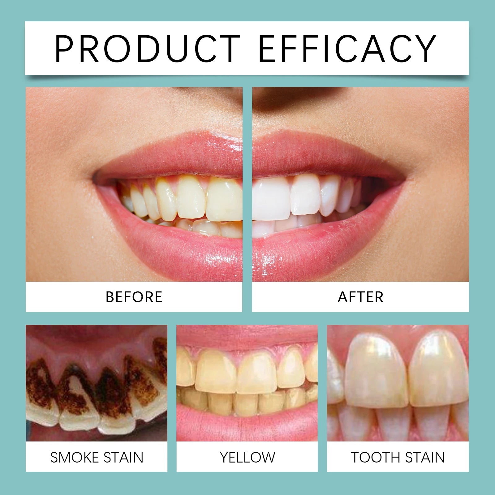 Instant Teeth Whitening Paint for Brighter Smile - 11