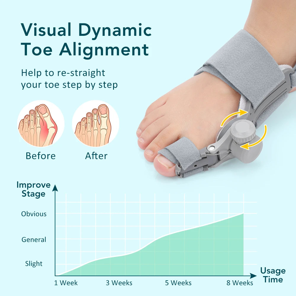 Adjustable Bunion Corrector for Hallux Valgus Pain Relief