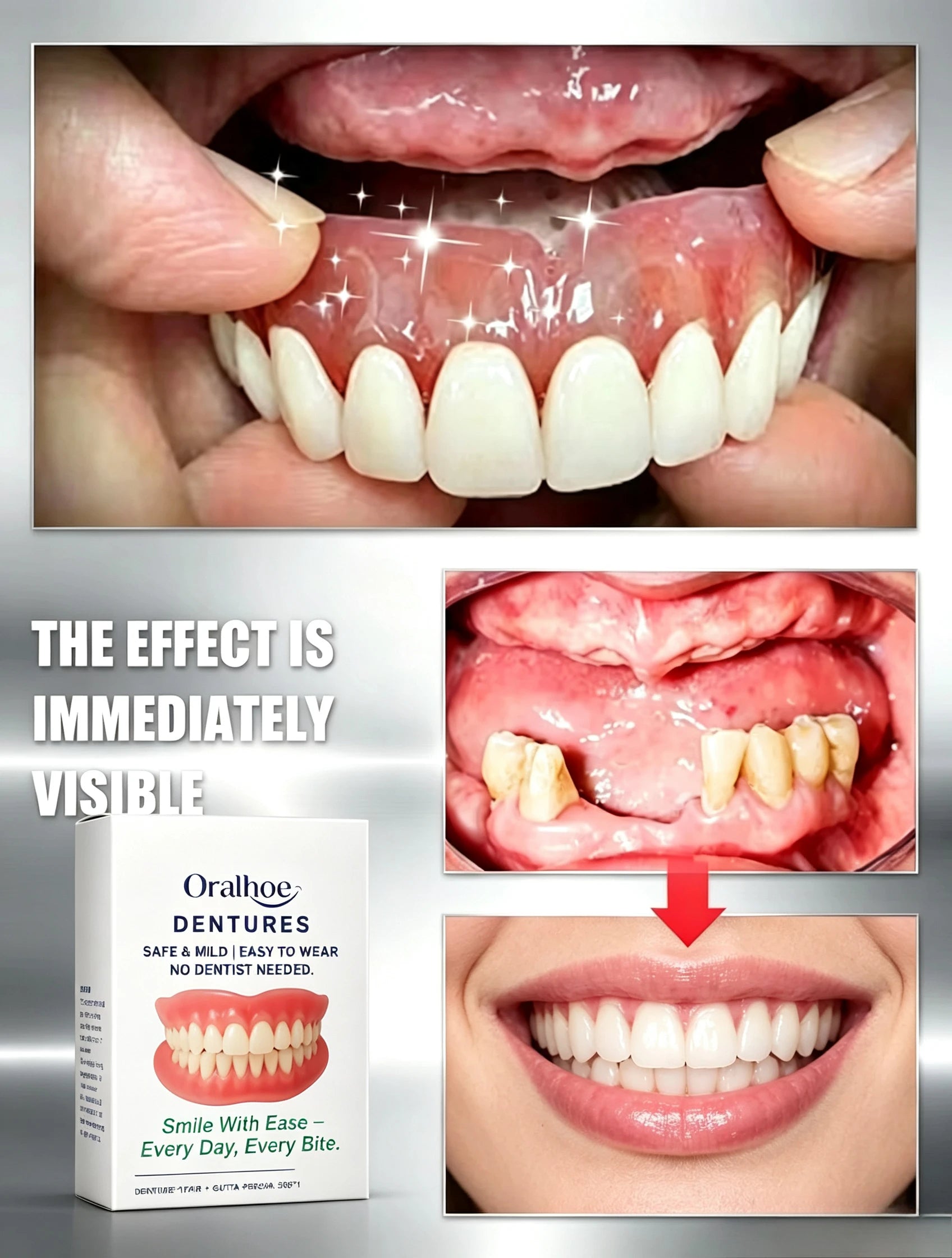 Adjustable Temporary Cosmetic Dentures for Instant Smile - 4