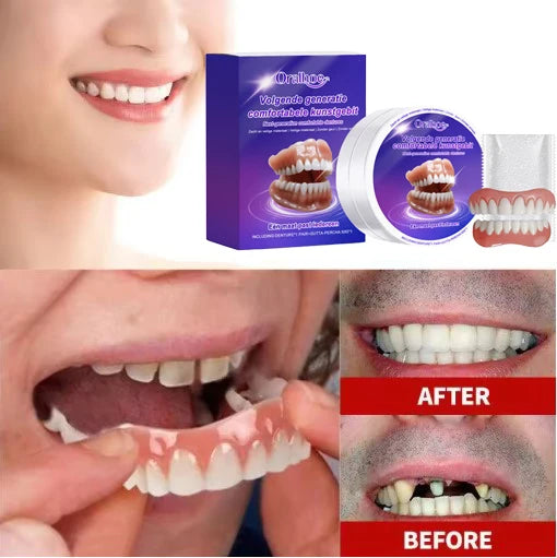 Comfortable Snap-On Silicone Dentures for Natural Smile
