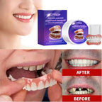 Comfortable Snap-On Silicone Dentures for Natural Smile