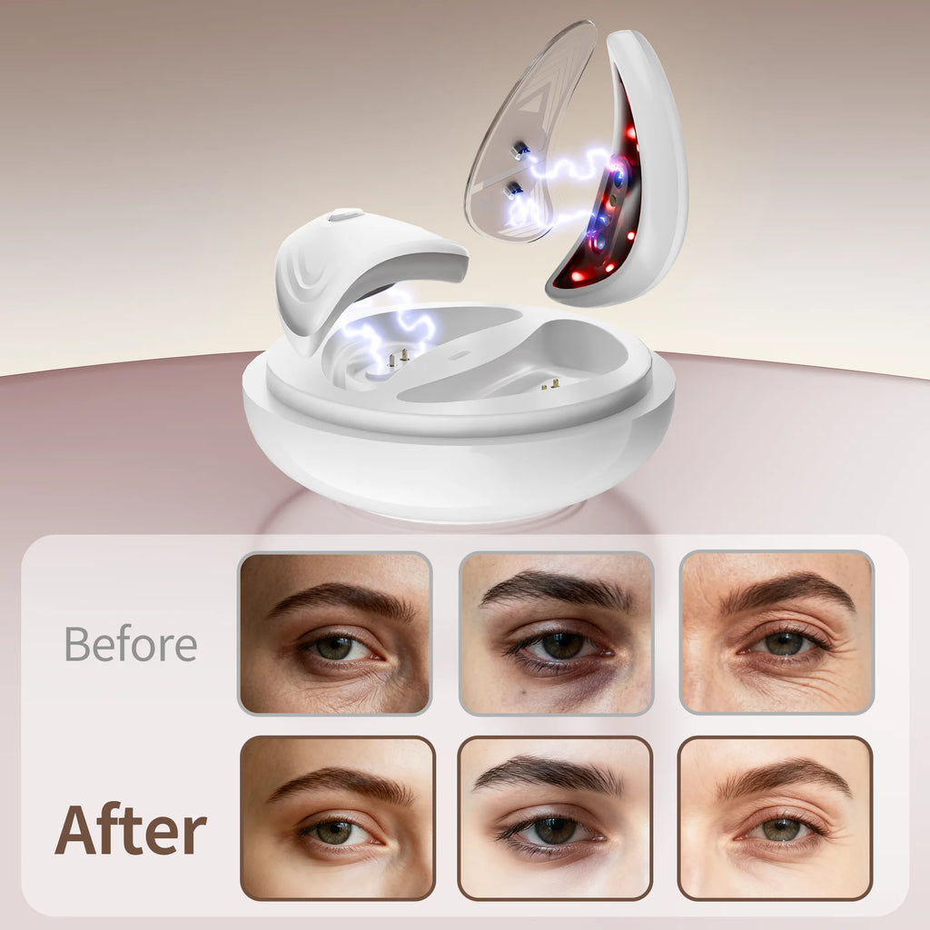 Red Light Microcurrent Eye Massager for Dark Circles