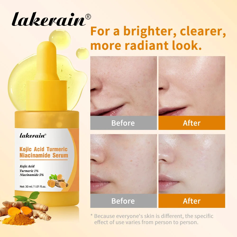 Brightening Kojic Acid and Turmeric Face Serum