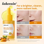Brightening Kojic Acid and Turmeric Face Serum for Glowing Skin