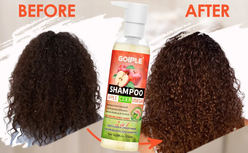 Goiple Apple Cider Vinegar Shampoo and Scalp Detox Treatment Set