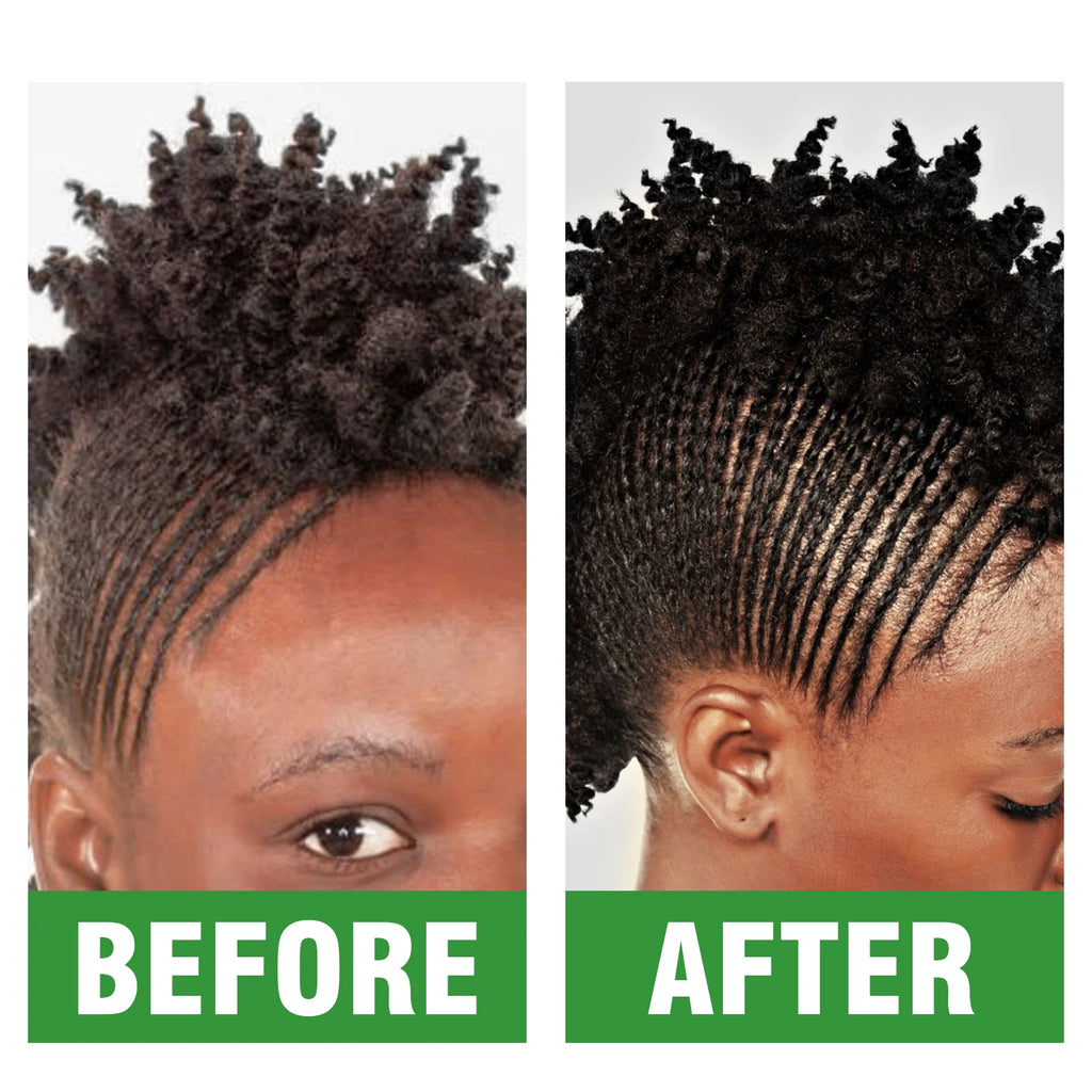 Rose Extract Braid Oil for Itchy Dry Scalp Cornrows Locs and Twists