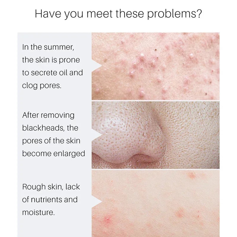Pore Minimizing Face Serum for Skin Tightening and Repair