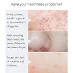 Pore Minimizing Face Serum for Skin Tightening and Repair