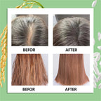 Goiple Rice Water Hair Growth Spray for Damaged and Frizzy Hair 100ml