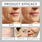 Water Ice Levin Botax Bliss Elixir Anti Aging Retinol Face Serum