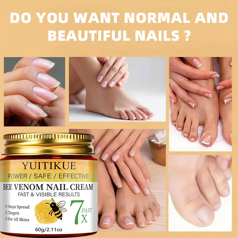 YUITIKUE Bee Venom Nail Repair Cream - Strengthening Nail Care Treatment