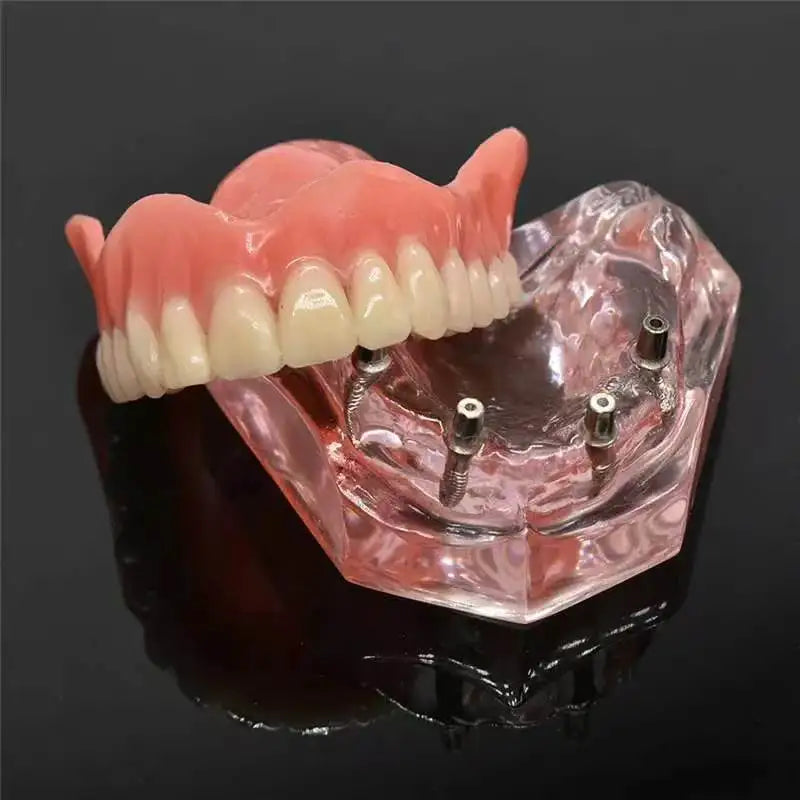 Cosmetic Silicone Teeth Covers for Smile Confidence - 1