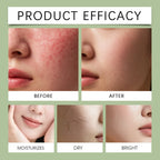 Hoygi Magnesium Milk Barrier Reset Jelly Mist Facial Toner Spray
