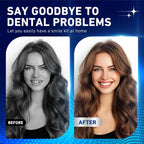 Snap-On Silicone Denture Veneers for Realistic Smile