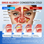 Electric Nasal Irrigation System for Sinus Relief and Allergy Care