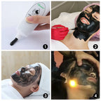 Carbon Laser Facial Gel for Skin Rejuvenation and Deep Pore Cleansing