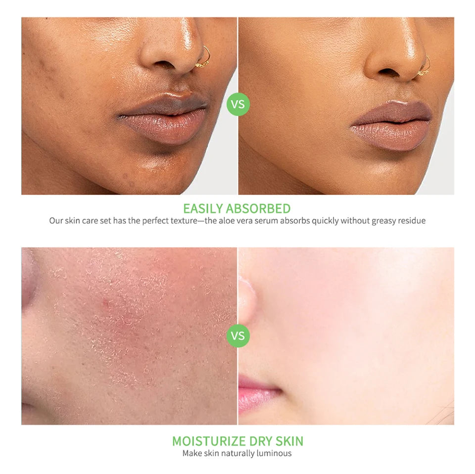 Soothing Aloe Vera Hydrating Face Gel