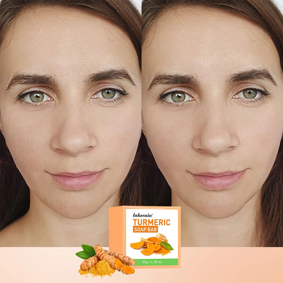 Turmeric Kojic Acid Brightening Soap Bar for Face and Body - 10