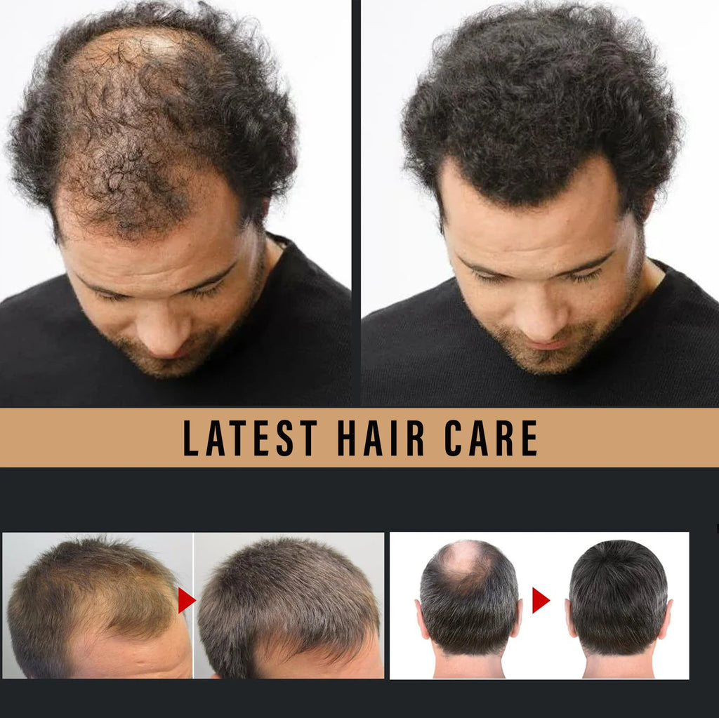 Water Ice Levin Root Activator Hair Growth Spray for All Hair Types
