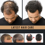 Water Ice Levin Root Activator Hair Growth Spray for All Hair Types