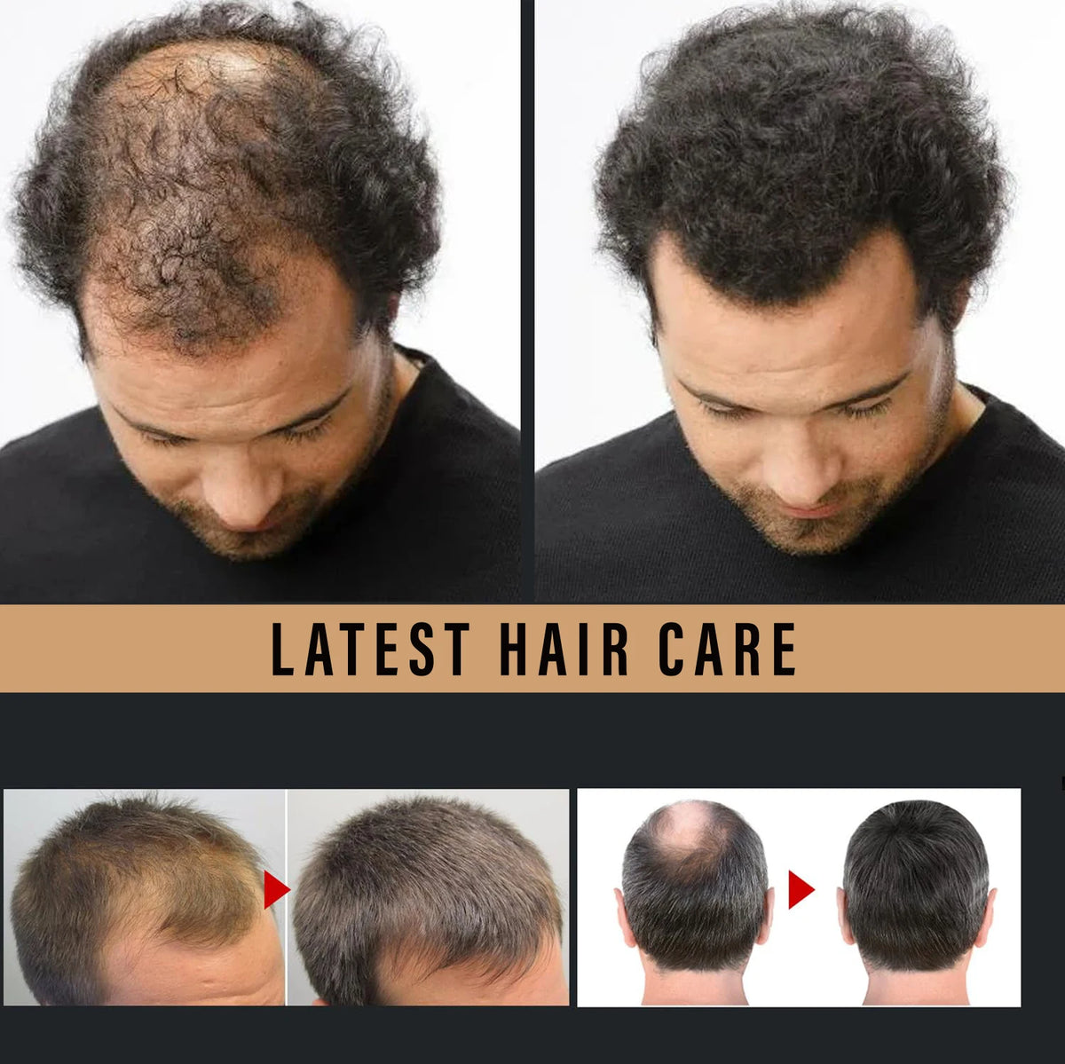 Water Ice Levin Root Activator Hair Growth Spray for All Hair Types