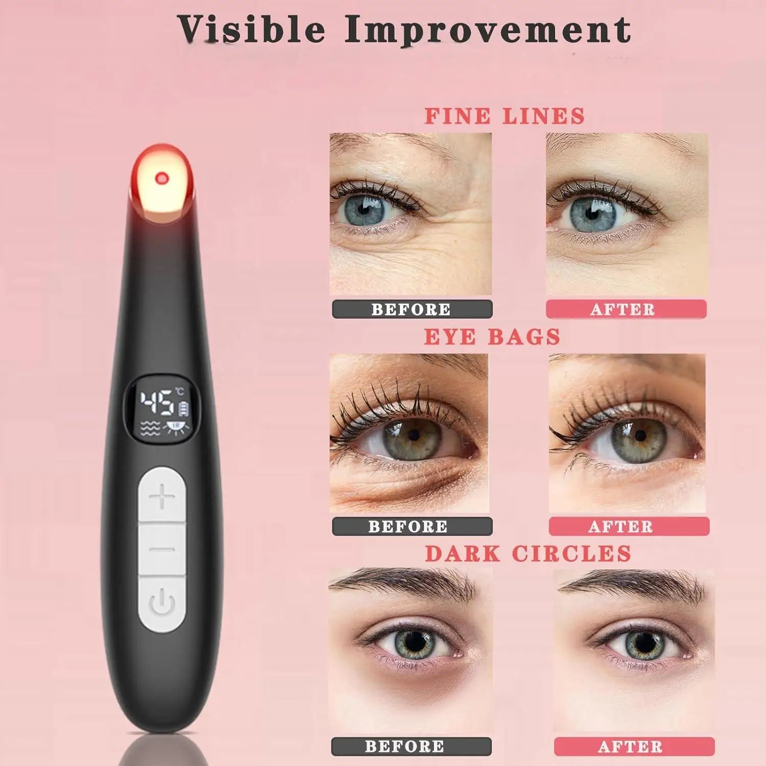 3-in-1 Heated Eye and Face Rejuvenation Massaging Wand - 2