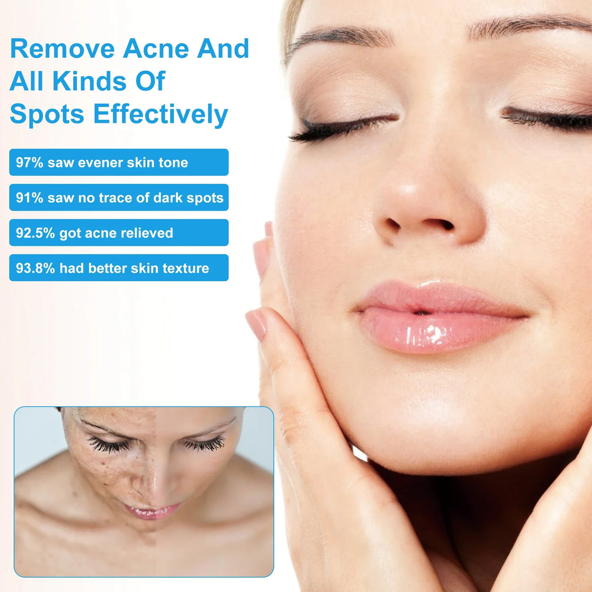 Brightening Face Cream Dark Spot Corrector and Skin Whitening Treatment