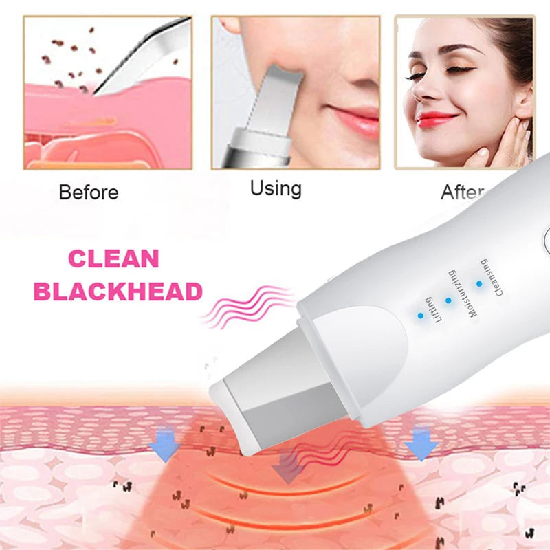 Ultrasonic Skin Scrubber Facial Pore Cleaner Blackhead Remover Device