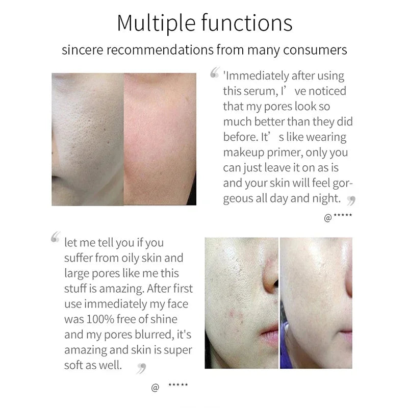 Pore Minimizing Face Serum for Skin Tightening and Repair