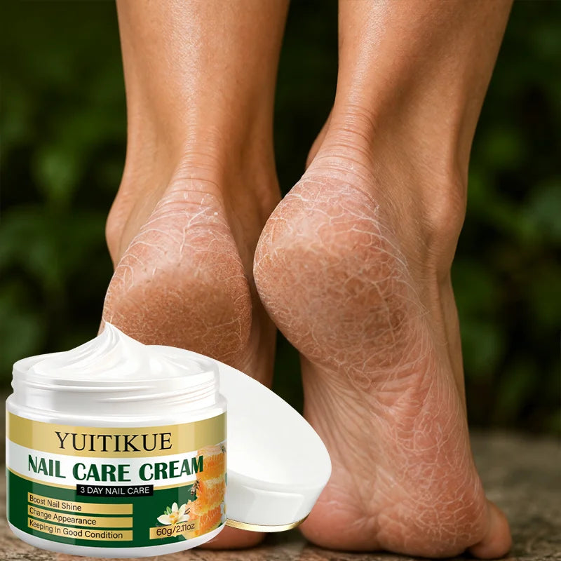 YUITIKUE 42% Urea Foot Cream Exfoliating Moisturizing Heel Treatment