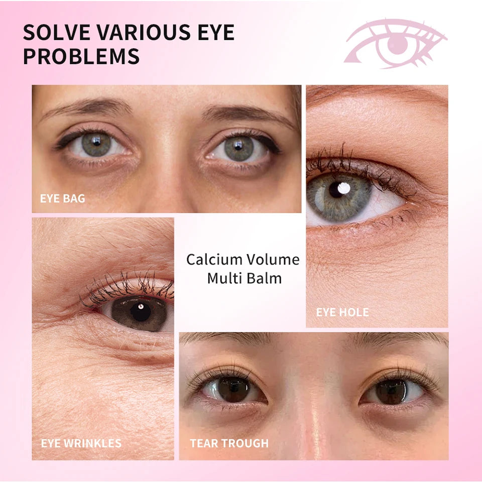 Calcium Volume Multi Balm for Eye Wrinkles and Dark Circles - 10