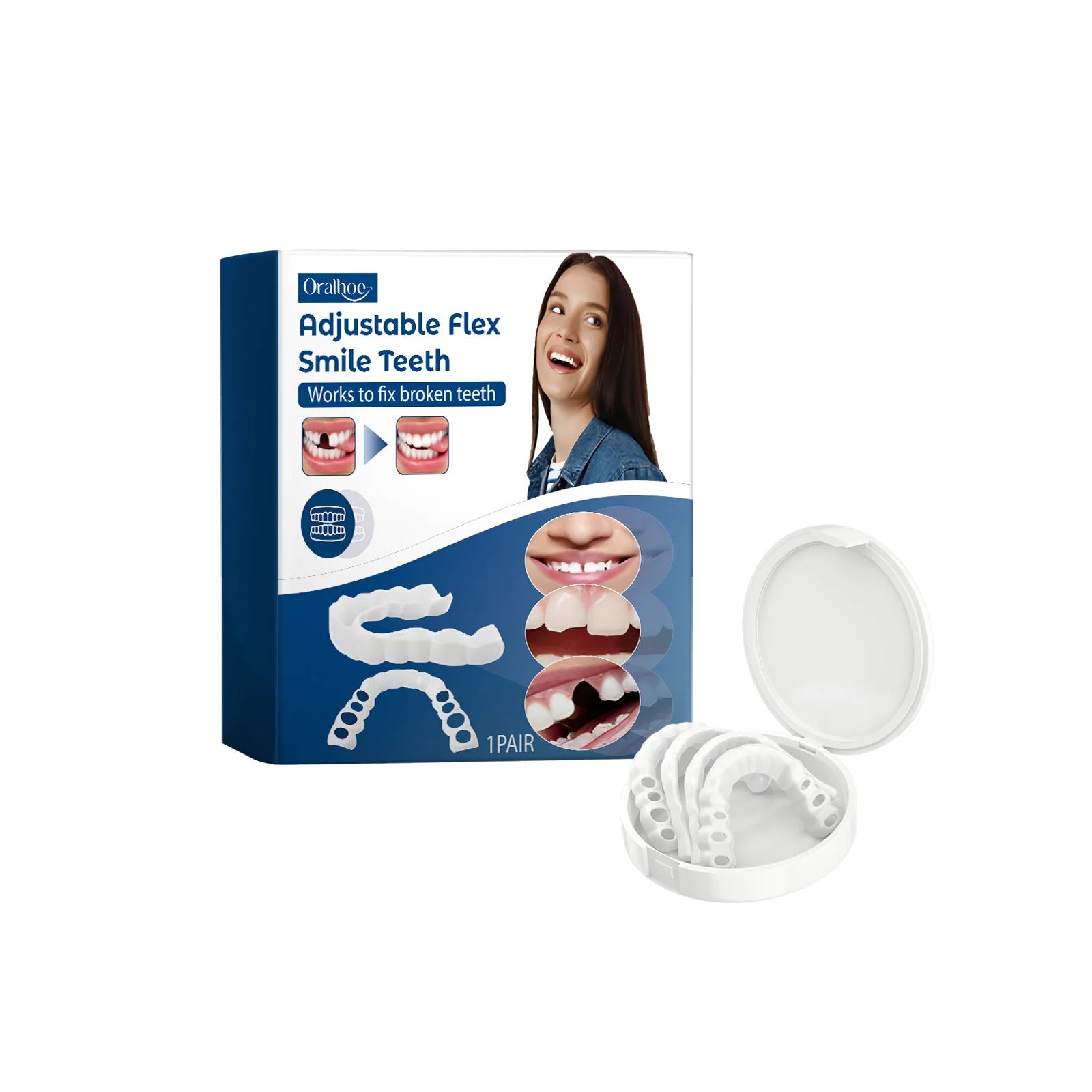Adjustable Snap-On Smile Veneers for Missing Teeth - 6