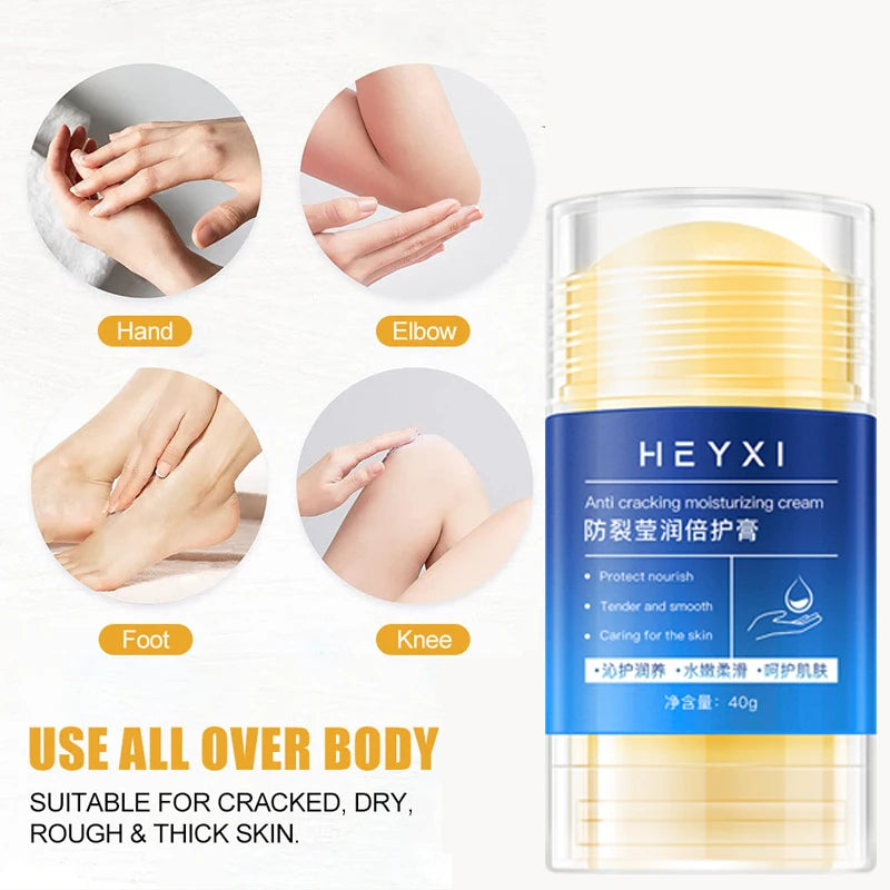 Heyxi Moisturizing Repair Balm Anti Cracking Cream for Hands and Feet