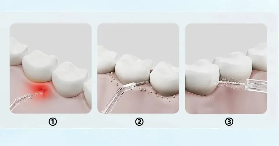 Mijia F300 Electric Oral Irrigator Portable Water Flosser Teeth Cleaner - 8