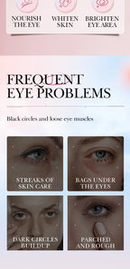 Retinol Anti-Aging Eye Cream for Dark Circles and Puffiness