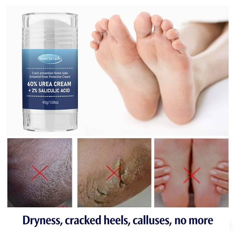 60 Percent Urea Foot Cream Salicylic Acid Repair for Cracked Heels - 6