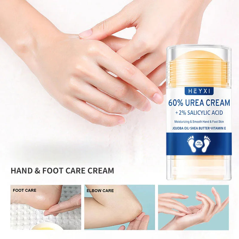 Heyxi 60 Percent Urea Cream Moisturizing Hand and Foot Repair Balm