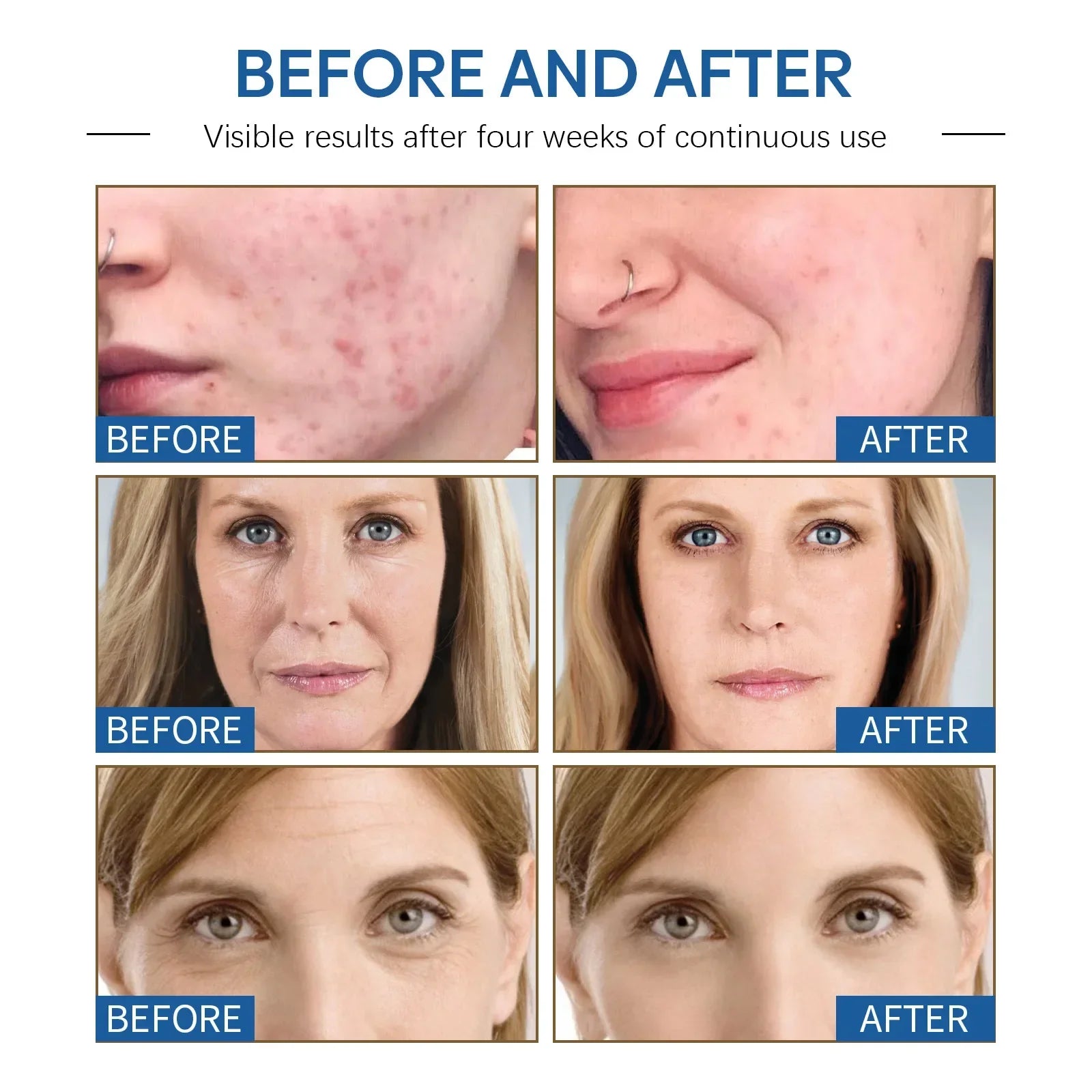 Anti-Aging Face Cream for Wrinkle Reduction and Skin Firming - 14