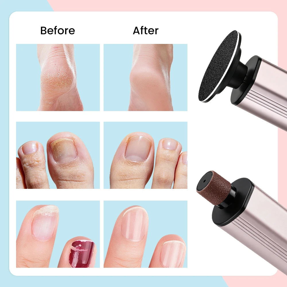 Electric Foot Callus Remover with 9 Speed Settings