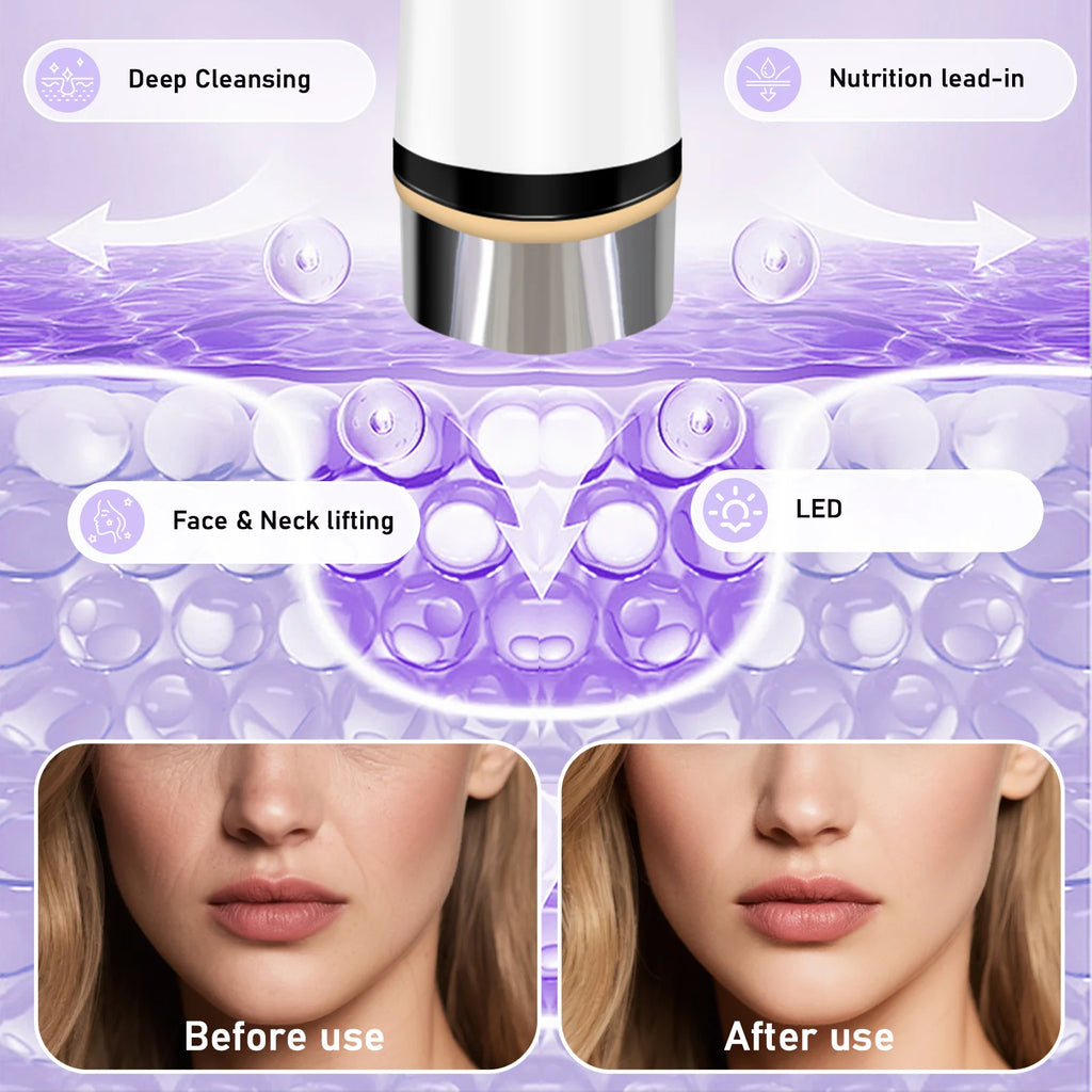Microcurrent Facial Massager for Skin Tightening and Lifting